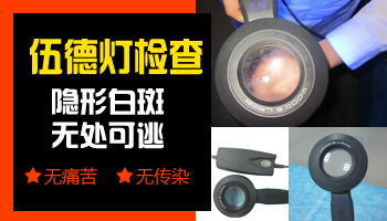 伍德灯下各种白斑图