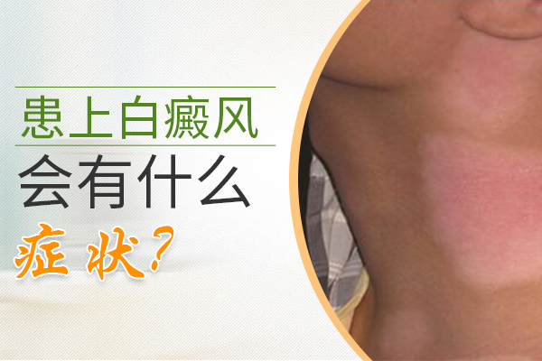 身上长了白癜风能治好吗”