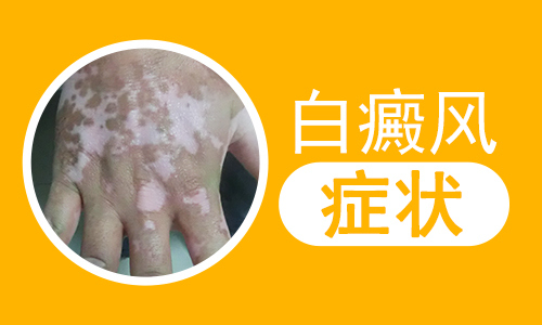 身上有白斑出现是不是白癜风呢”
