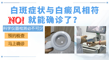 白癜风白斑初期症状图的表现