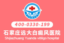身上有大片白癜风要怎么治”