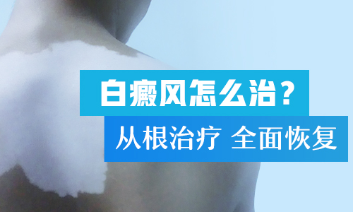 儿童患了白癜风应该如何治疗”