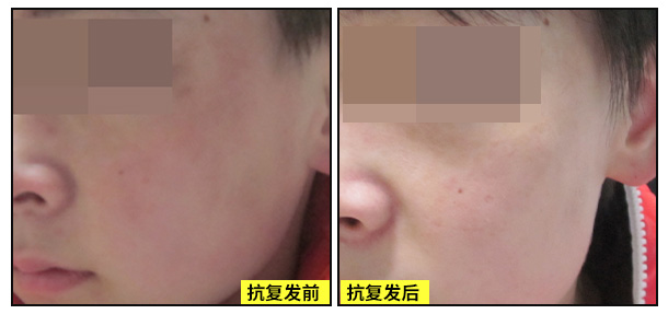 迎五.一劳动:特邀京冀白癜风专家莅临我院开展联合会诊