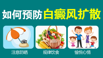 大腿上有一块一块的白斑扩散了怎么治