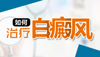 手上长了白癜风怎么治疗好的快