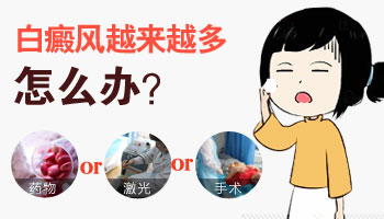 腿部白癜风越来越多怎么治疗好