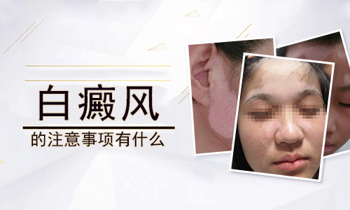 怎么做才能减少白癜风的复发几率”