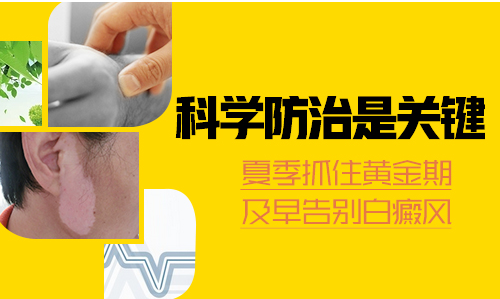 治疗面部白癜风的最佳方法是什么”