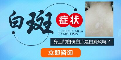 孩子脸上有淡白斑图片