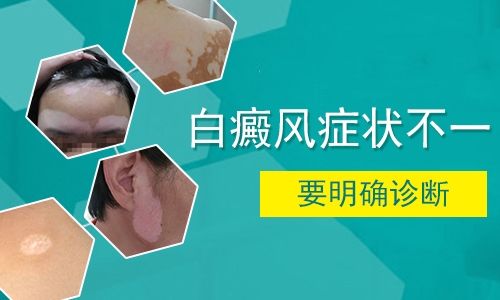 长了白癜风后饮食上要注意什么”