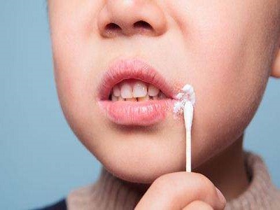 治疗孩子的白癜风该怎么办”