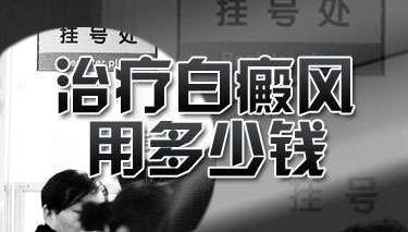 肢端型白癜风治疗要花多少钱”