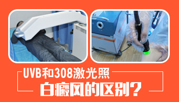 做伍德灯检查结果显示白色”