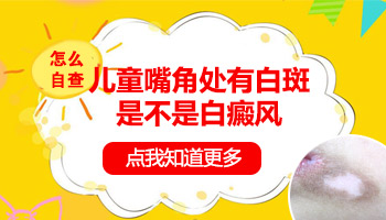 白癜风不扩散稳定期康复率大不大