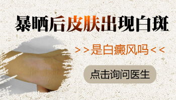 手上起白斑图片会不会自己消失