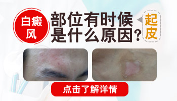 手上皮肤出现白块会不会自己消失