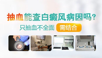 小孩手上身上有白块图片要怎么才能祛除