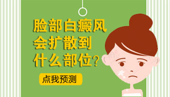 婴幼儿有白癜风白点点初期症状鉴定图