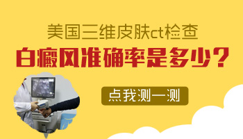 哪个医院能治好手上白癜风用的什么技术