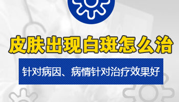 白斑照伍德灯亮白色能判断就是白癜风吗