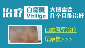 宝宝耳朵旁边有一片白斑会不会自己消失
