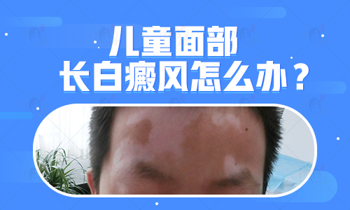 脸部出现一块白咋办”