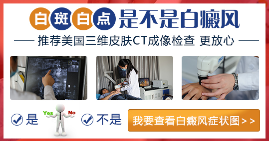 小孩白癜风治疗