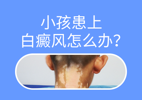 额头上长白癜风会是什么样子图片