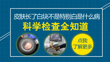 脸部白癜风的症状表现有哪些