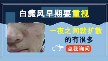 脸上一块皮肤变成白色怎么回事