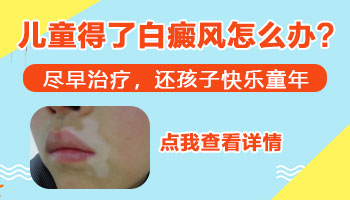 小孩白癜风治疗