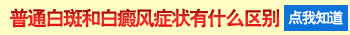 看白癜风比较好的医院是哪家用的什么技术