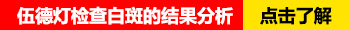 白癜风医院哪家好白癜风治疗去哪怎么治好的