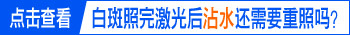 身上有白斑能治好吗 引起白点病的主要原因