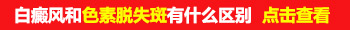 稳定期白癜风巴掌大怎么治康复的快
