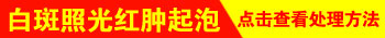 保定白癜风专科医院哪家好治疗的比较好