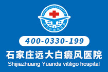怎么治疗大面积的白癜风啊”