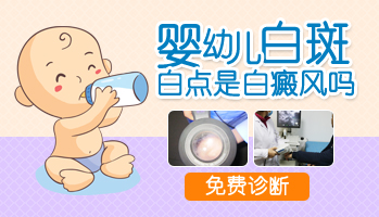 儿童患上白癜风要怎么治”