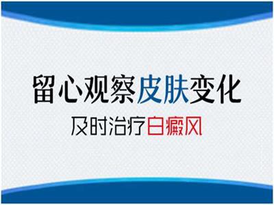腿上有长白斑是白癜风吗”