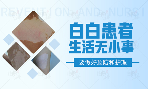 男性白癜风该如何护理好呢”
