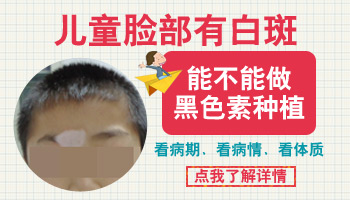 脸上长白癜风该怎么处理好”