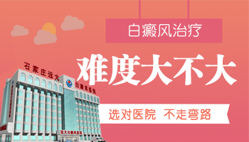 怎么判别不完全性白癜风?