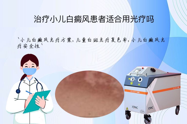 治疗小儿白癜风患者适合用光疗吗
