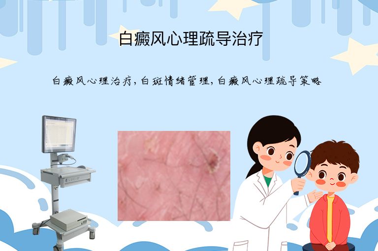 白癜风心理疏导治疗”