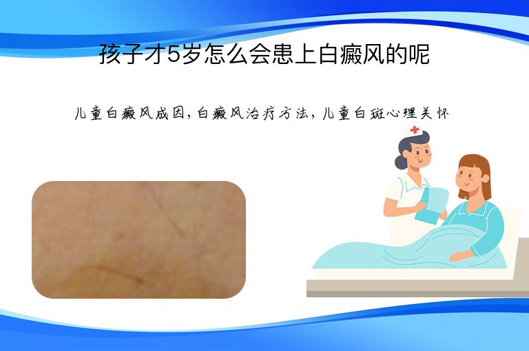 孩子才5岁怎么会患上白癜风的呢”