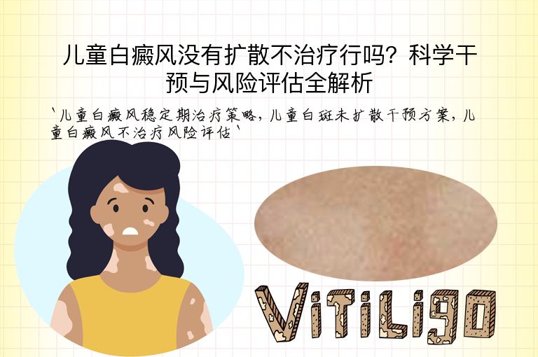 儿童白癜风没有扩散不治疗行吗？科学干预与风险评估全解析