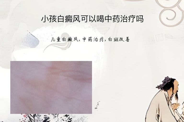 小孩白癜风可以喝中药治疗吗”