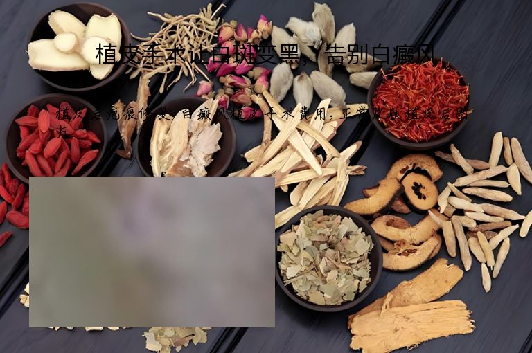 植皮手术让白斑变黑，告别白癜风”