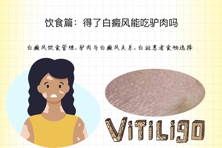 饮食篇:得了白癜风能吃驴肉吗”