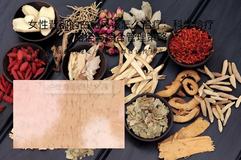 女性背部的白癜风该怎么治疗:科学诊疗路径与综合管理策略